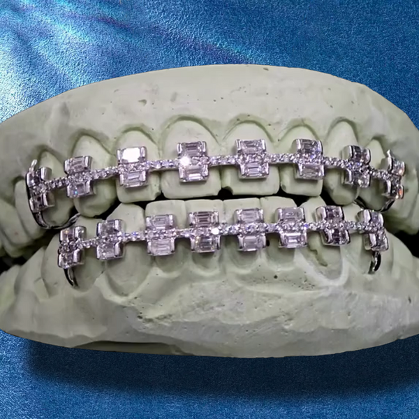 Custom Silver Grillz Iced Out Teeth Jewelry with VVS Moissanite